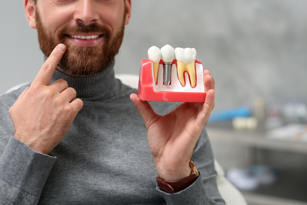 man holding Dental Implants in Federal Way, WA