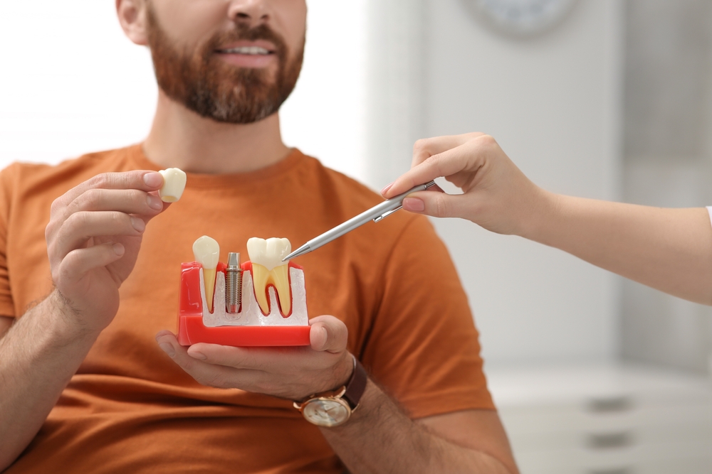 What is a dental crown? 5 Reasons You Would Need a Crown